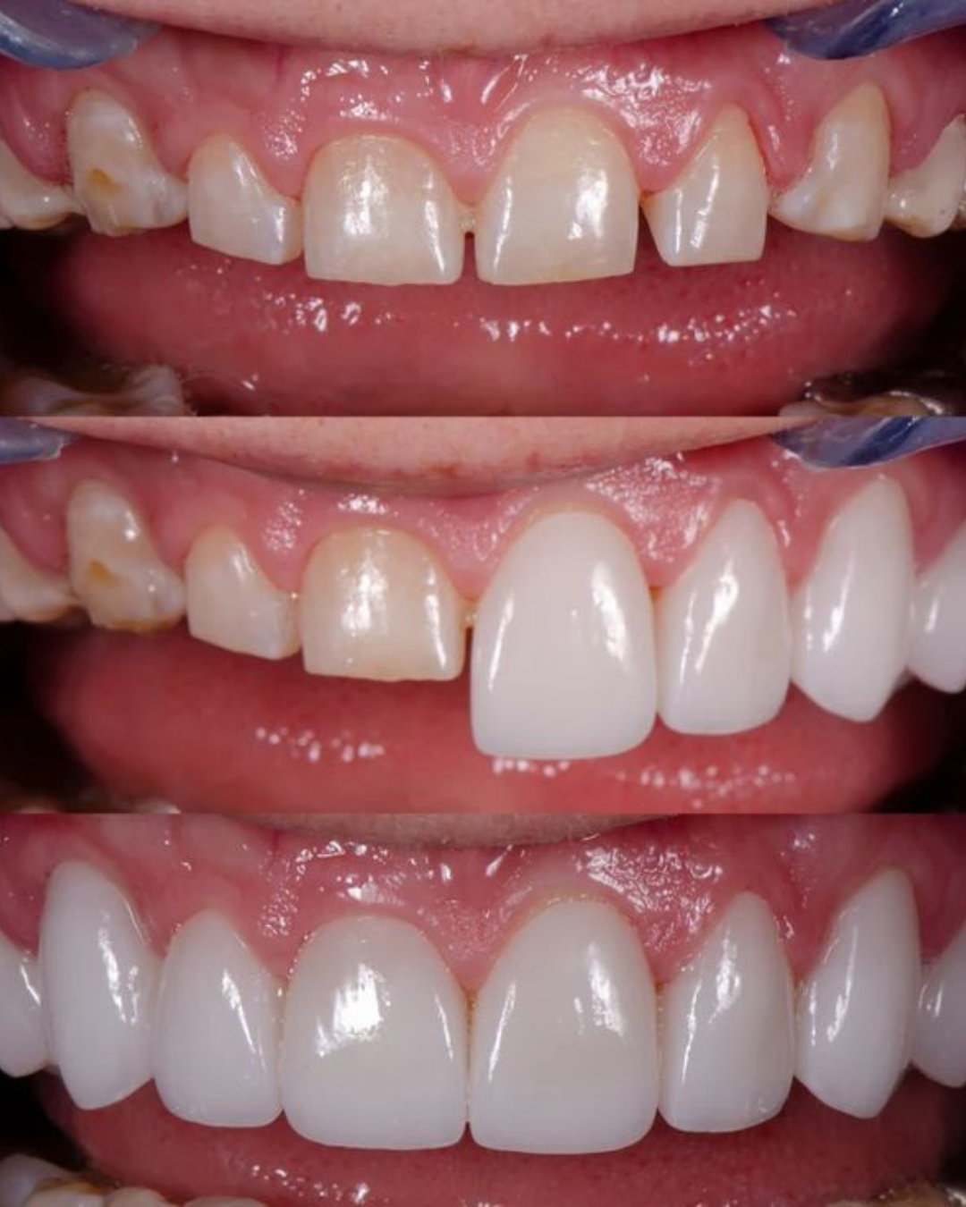 Untitled design (73) Untitled design (73)