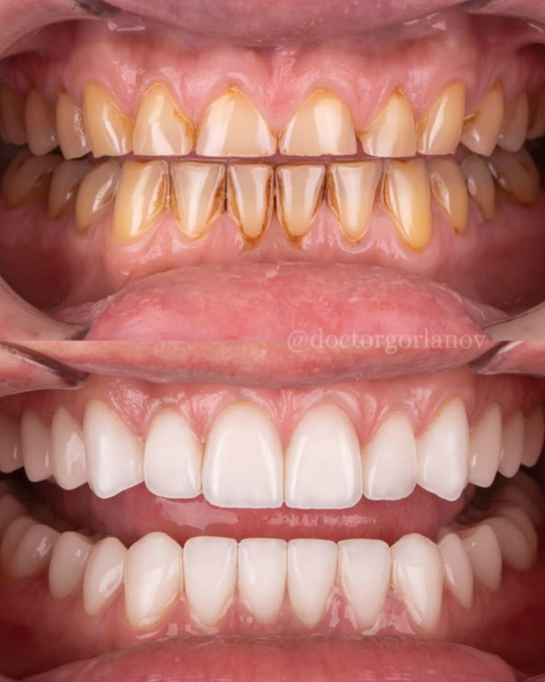 Untitled design (96) Untitled design (96)