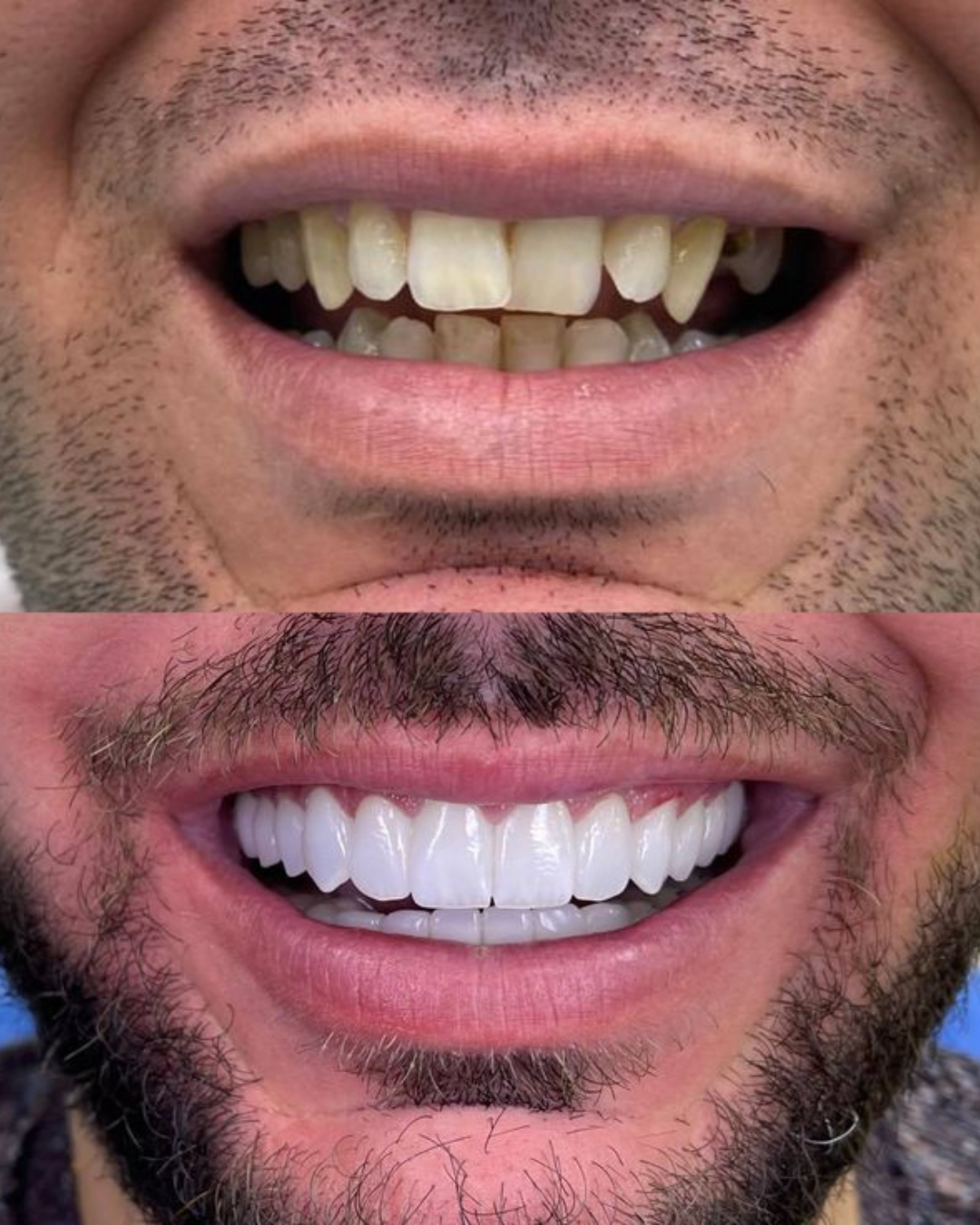 Untitled design (97) Untitled design (97)